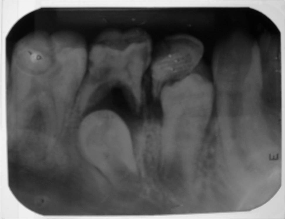 cirurgia