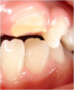exerc 4