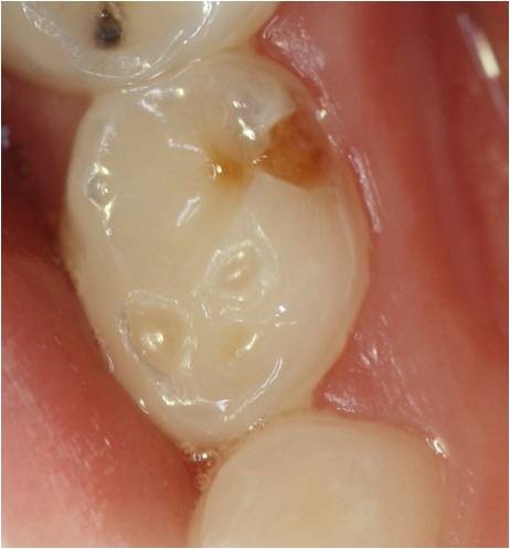 exerc 3